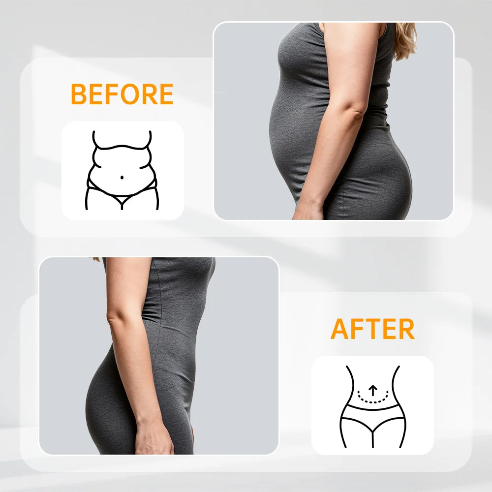 Corset Waist Trainer – Double Belt Cincher